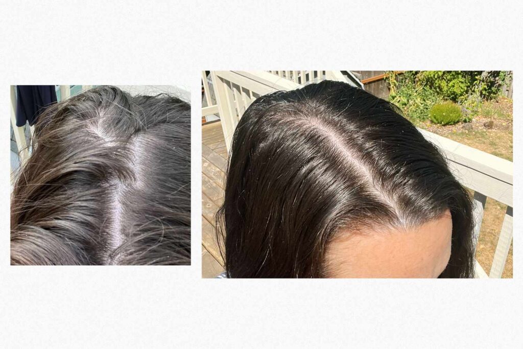 Nutrafol Hair Serum Before After